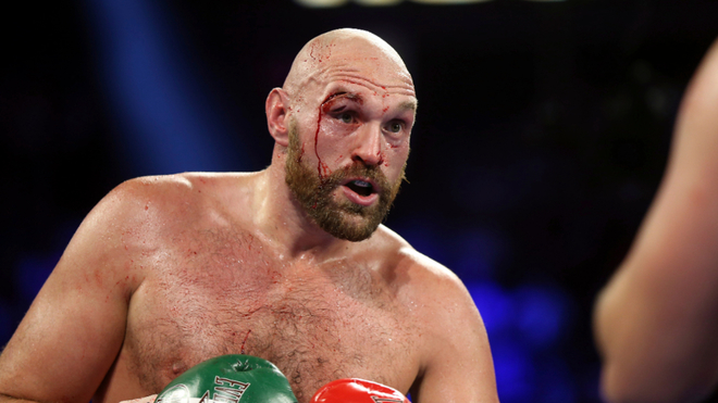 BOXEO: TYSON FURY TRATA DE BURLAR EL ANTIDOPAJE